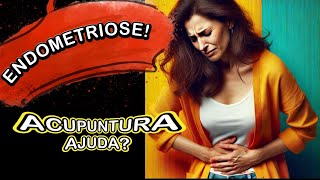 Como a Acupuntura Pode Reduzir os Sintomas da Endometriose [upl. by Yssac172]