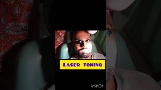 Laser toniniglaser laserskincare shortsfeed skincare ytshorts shorts subscribe [upl. by Grounds]