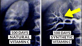 We Finally Know What Type Of Vitamin C Is Best [upl. by Eilak]