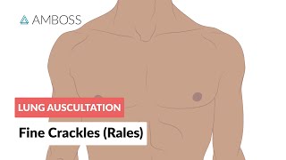 Fine Crackles Rales  Lung Auscultation  Episode 2 [upl. by Esiom570]