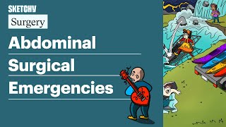 Abdominal Surgical Emergencies Internal Medicine  Sketchy Medical [upl. by Fast]