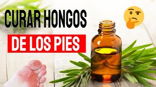 Cómo Eliminar LOS HONGOS DE LOS PIES RAPIDO – Tratamiento Natural Para el Pie de Atleta [upl. by Cherlyn]