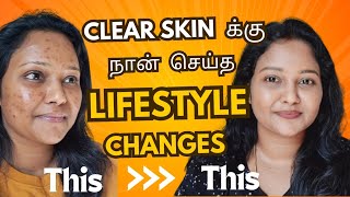 Acne to clear skin journey  This lifestyle changes for clear glowing Skin ✨️ acne acnetreatment [upl. by Gladwin874]