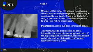 Pulp and Periapical Diagnosis  Endodontics  Radiographic Interpretation [upl. by Elvira]