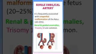 TIPS 31 SINGLE UMBILICAL ARTERY IN TAMIL  DEFINE CAUSES REASON COMPLICATION [upl. by Idham509]