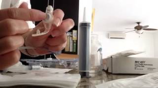 Diferencia entre botón y sonda foley para gastrostomia [upl. by Edivad]