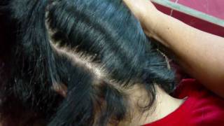 Dandruff Treatment at Home Natural Dandruff Solution Free [upl. by Walters]