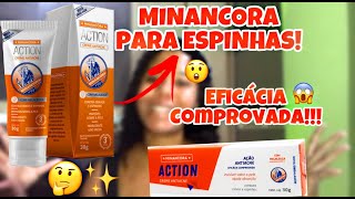 MINANCORA ACTION ANTIACNE ✨ O QUE É COMO APLICAR ADVERTÊNCIAS ❤️ [upl. by Elok]