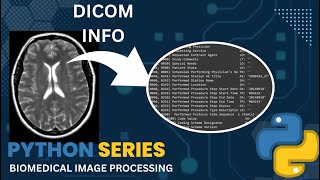 Dicom info in Python  Biomedical Image Processing [upl. by Edbert787]