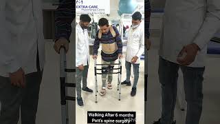 Walking After Potts Spine Surgery  Potts Spine Rehabilitation Neuro Rehabilitation Lucknow [upl. by Aneev281]