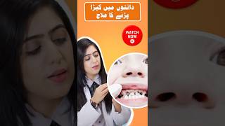 DENTAL FILLINGS TO STOP CAVITIES  Dr Ayesha Zubair [upl. by Nnave]