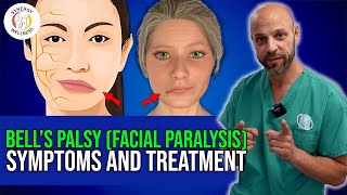 Bells Palsy Facial Paralysis Symptoms amp Treatment Options [upl. by Olethea78]