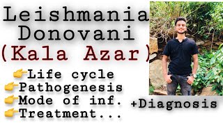 Leishmania donovani  life cycle  diagnosisTreatment etc Leishmania Leishmaniasis Parasitology [upl. by Aneras]