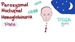 Paroxysmal Nocturnal Hemoglobinuria PNH  Hemolytic Anemia  Complement Alternative Pathway [upl. by Oecile599]