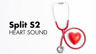 Fixed Split S2  Heart Sounds  MEDZCOOL [upl. by Llebiram302]