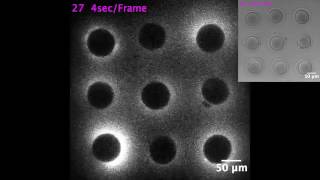 Flash of light that sparks when a sperm meets an egg [upl. by Reyaht]