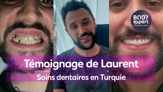 CLINIQUE DENTAIRE TURQUIE  🦷 Témoignage laurent  gummy  7 implants  28 couronnes  BODYEXPERT [upl. by Edas]