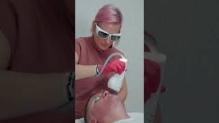 Moxi® Laser Treatment at ALDA Aesthetics in Hanover MA [upl. by Georgeanna]