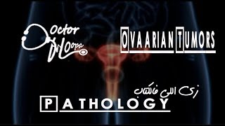 Ovarian Tumors  Pathology زي اللي فالكتاب  Doctor HOopa [upl. by Eannej]