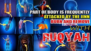 RUQYAH SHARIAH DESTROY SIHR JINN AND DEMONS INSIDE ORGANS BODY CAUSING SICKNESS ILLNESS [upl. by Cibis]