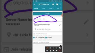 HTTP INJECTORZW SETTINGSNETONE USERS [upl. by Merp818]