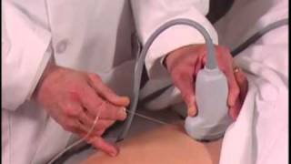 How To Ultrasound Guided Hip Injection Scanning Technique Video [upl. by Stanwinn]