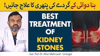 Kidney Stone Treatment  Gurde ki Pathri Ka Dawai Se ilaj in UrduHindi [upl. by Einwahs]