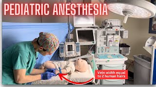 Why anesthesia for children is so different [upl. by Yerbua762]