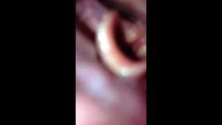 Vocal Folds with iPhone [upl. by Acinnej]