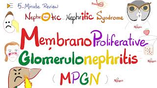 Membranoproliferative Glomerulonephritis Type 1 and 2  MPGNI amp MPGNII  Nephrology [upl. by Mather]