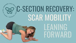 Csection Recovery Scar Mobility in Leaning Forward Position [upl. by Sharron233]