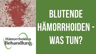 Blutende Hämorrhoiden  Was kann man tun wenn die Hämorrhoiden bluten [upl. by Sivel]