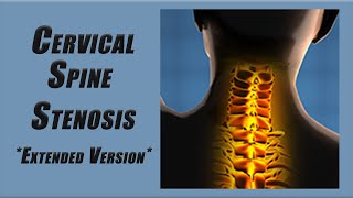 Best Exercises for Stenosis in the Cervical Spine  Slower Pace and More Reps [upl. by Bluma439]