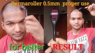 How to use derma roller system 05mm proper for better result।Sonu Kumar Mishra। dermarollersystem [upl. by Oigroeg]