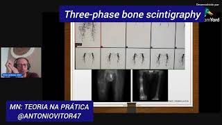 Threephase bone scintigraphy cintilografia óssea Trifásica scintigraphy cintilografia [upl. by Francesca]