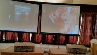 NYSORA Middle East 2016 workshops Paravertebral nerve block USG guided [upl. by Legnaleugim]