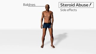 Side Effects of Steroids Abuse [upl. by Abott]