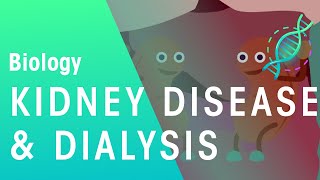 Kidney Disease and Dialysis  Health  Biology  FuseSchool [upl. by Aisatal148]