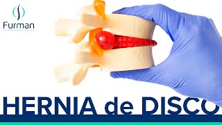 Cuáles son los SÍNTOMAS de una hernia discal 🧨 Hernia de disco [upl. by Ahsaele]