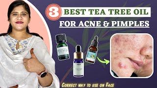 Top 3 Tea Tree Oil  For Acne amp Pimples  Correct Way to use on Face  Dr Arwa Bohra [upl. by Netsuj352]