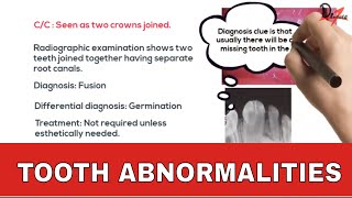 Tooth Abnormalities Some alterations in size [upl. by Nadaba258]