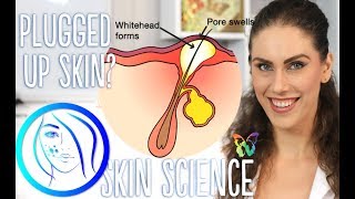 WHY DOES MY SKIN GET CLOGGED AND HOW TO GET RID OF CLOGGED PORES  Skin Science Episode 6 [upl. by Akcimehs937]