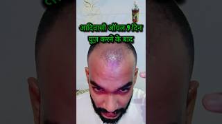 ADIVASI HAIR OIL HONEST REVIEW DAY 9 😊 adivasi adivasioil haircare hairstyle [upl. by Sabir177]