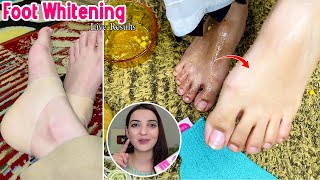 Instant Feet Whitening Successful DIY Tan Removal at Home Easy Steps [upl. by Zigmund212]