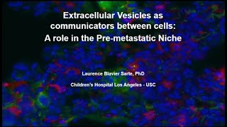 Extracellular Vesicles as Communicators Between Cells  A Role in Cancer Dissemination [upl. by Albers]