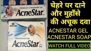 ACNESTAR GEL AND ACNESTAR SOAP REVIEW II ACNE PIMPLE CREAM AND ACNE PIMPLE SOAP [upl. by Quartas]