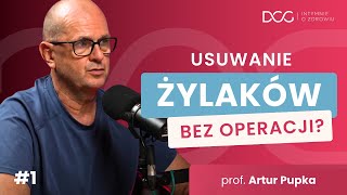 Usuwanie żylaków BEZ OPERACJI Wchodzisz i wychodzisz  Prof Pupka  Intymnie o Zdrowiu 1 [upl. by Hnah374]