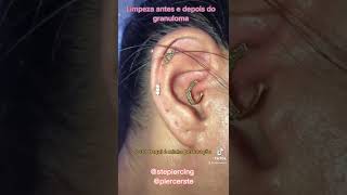 Limpando piercing inflamado 😰 [upl. by Aeneg]