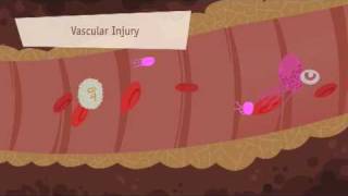 Hemostasis Coagulation and Fibrinolisis [upl. by Eeltrebor]