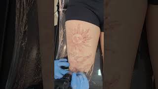 Apagando o sol a laser  Remoção de Tatuagem [upl. by Enert]